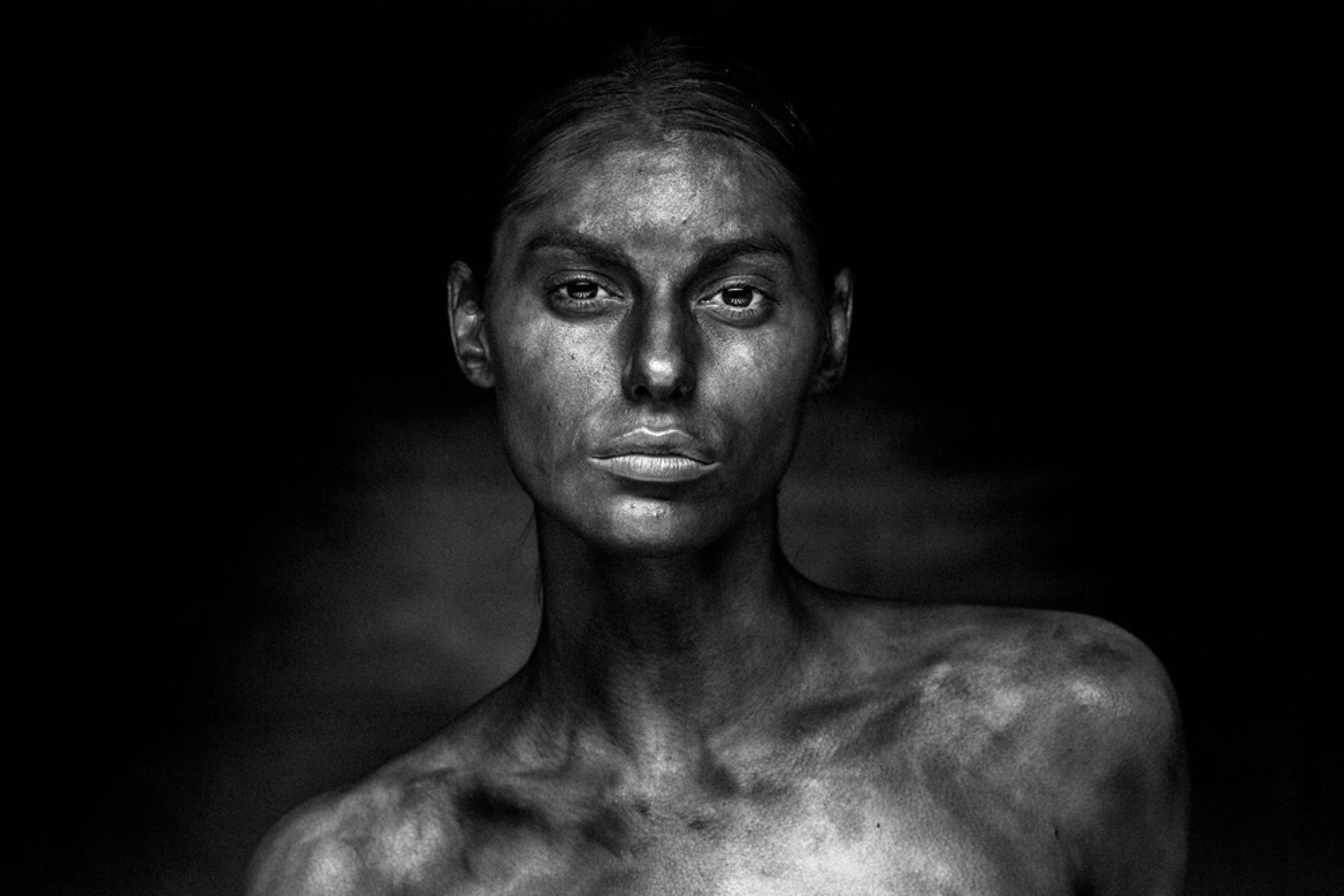 Portfolio image